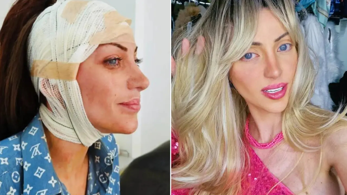 barbie bebege benzemek icin 27 kez ameliyat oldu brezilyali fenomen 31 yasinda hayatini kaybetti fPrYEtGt.jpg