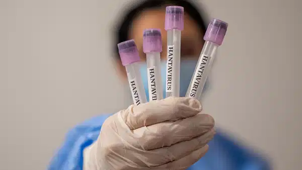 profesorden-dikkat-ceken-hantavirus-aciklamasi-yeniden-bir-pandemi-ihtimali-yok-ama-tedbir-sart-GOb5IcN5